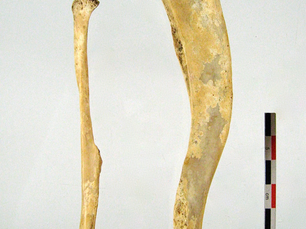Tibia Fibula lateral 02