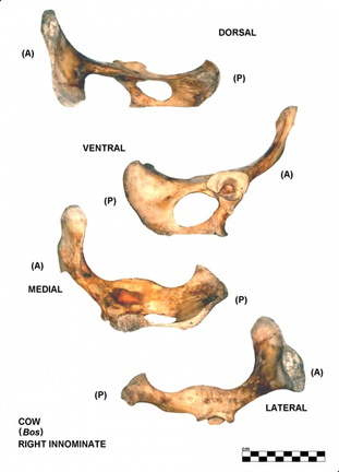 Coxal droit