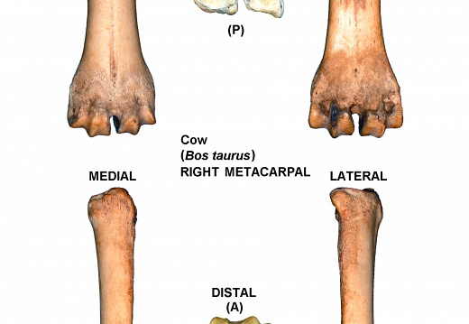 Right metacarpal