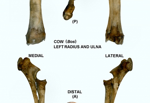 Radio y ulna izquierdos