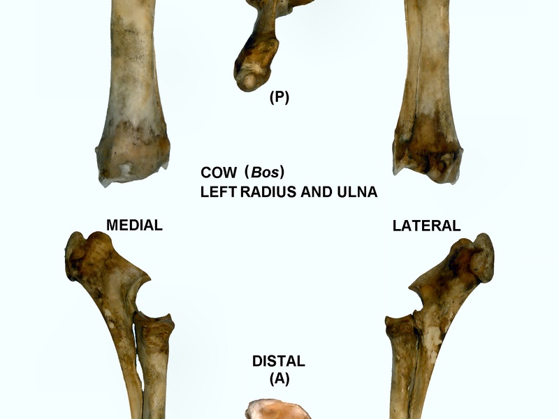 Radio y ulna izquierdos