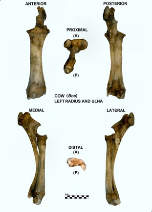 Radius et ulna gauches