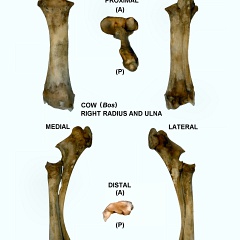 Radius et ulna droits