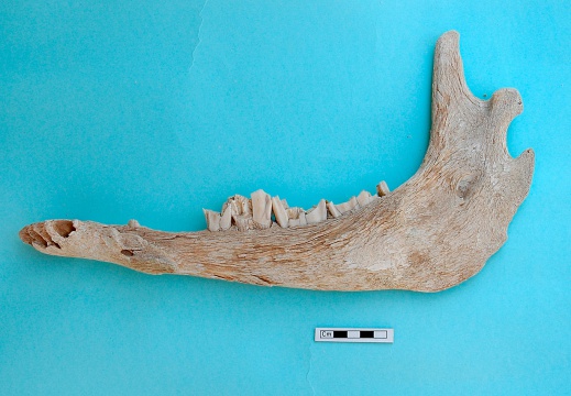 Mandible : medial view