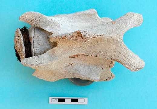 Cervical vertebra: dorsal view