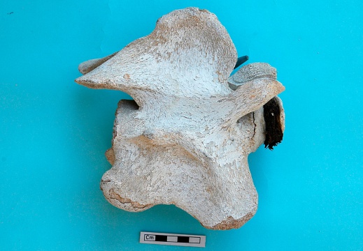 Cervical vertebra: right side view