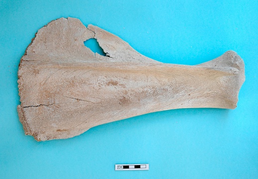 Scapula : vue latérale