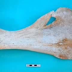 Scapula : vue médiale