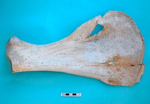 Scapula: medial view