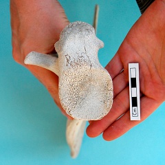 Scapula : vue ventrale