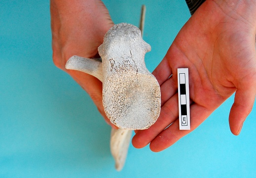 Scapula: ventral view