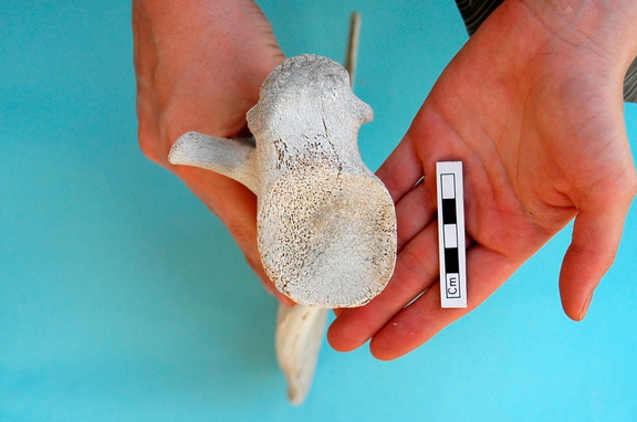 Scapula: ventral view