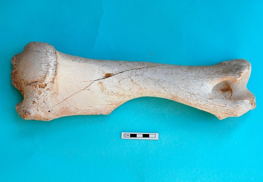 Humerus: posterior view