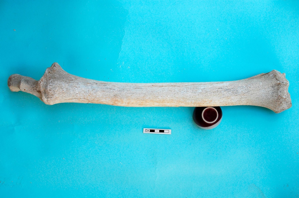 Radius et ulna : vue antérieure