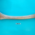  Radius and ulna: side view