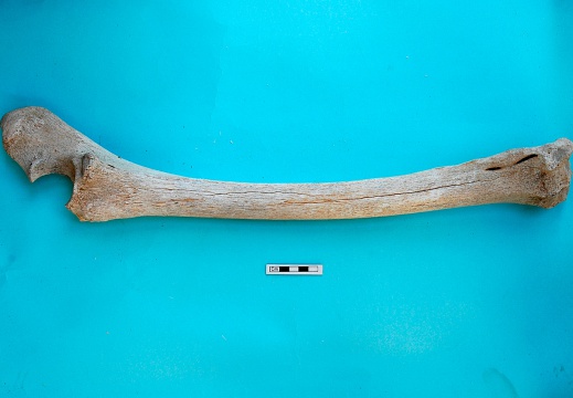  Radio y ulna : vista lateral