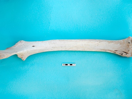  Radius and ulna: posterior view