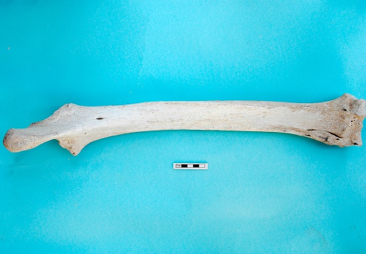  Radius and ulna: posterior view