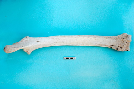 Radius et ulna : vue postérieure