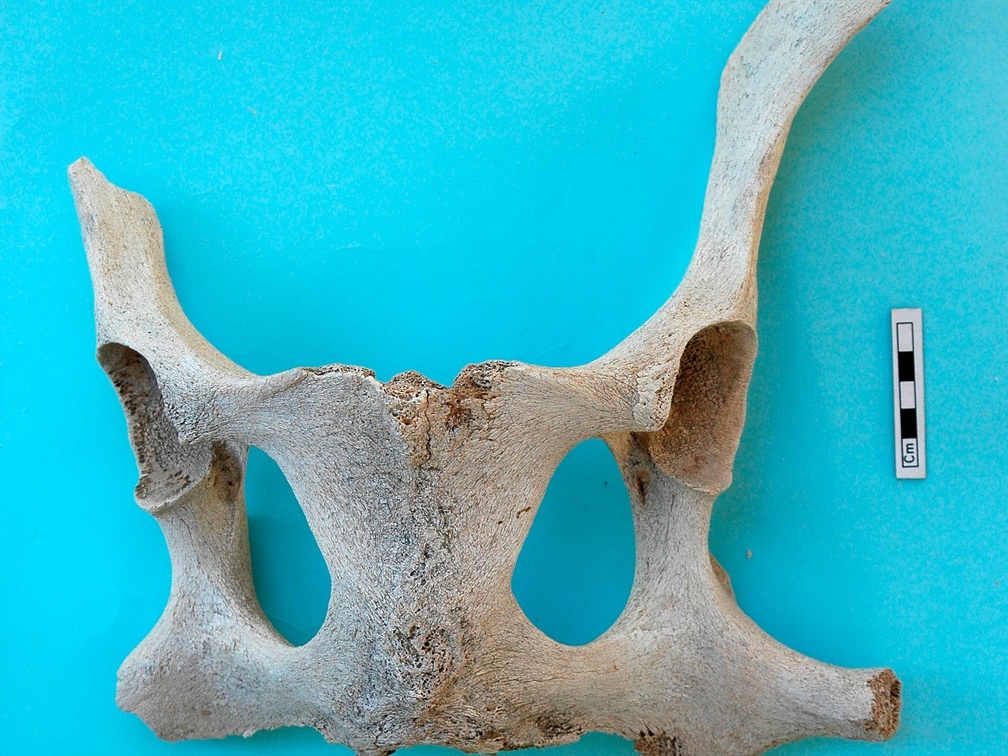 Pelvis: dorsal view