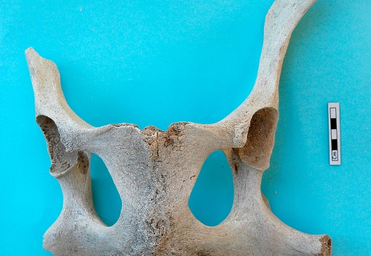 Pelvis : vue dorsale