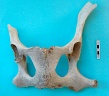 Pelvis : vue dorsale