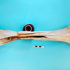 Femur: anterior view