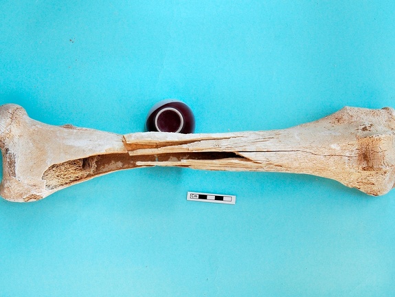 Femur: anterior view