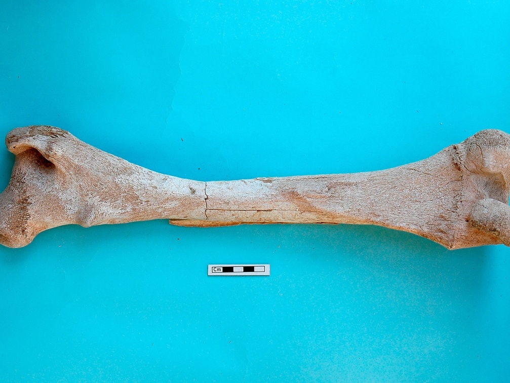 Femur: posterior view