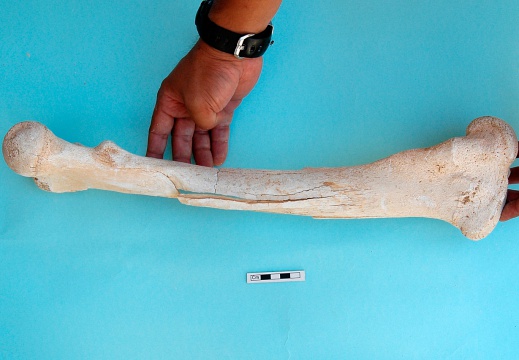 Femur: medial view