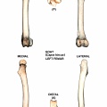 Left femur