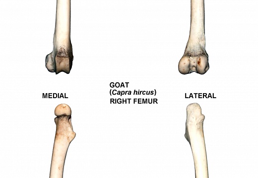 Right femur