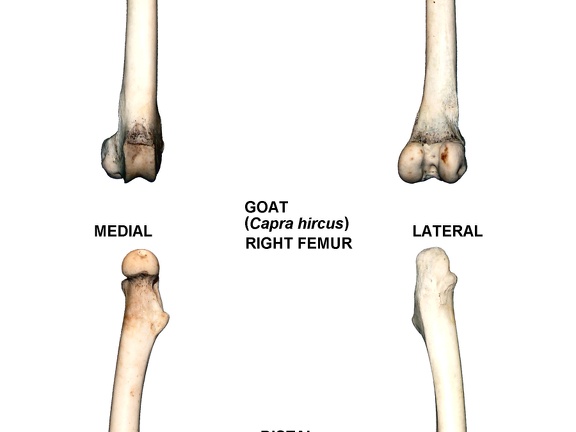 Fémur droit