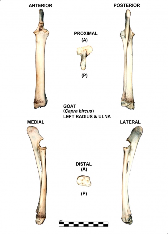 Radius et ulna gauches