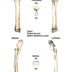 Right radius and ulna