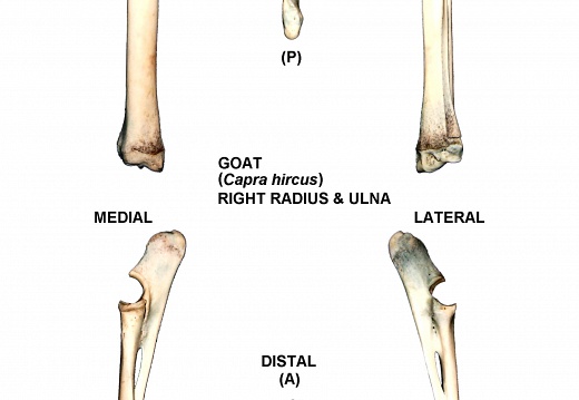 Right radius and ulna