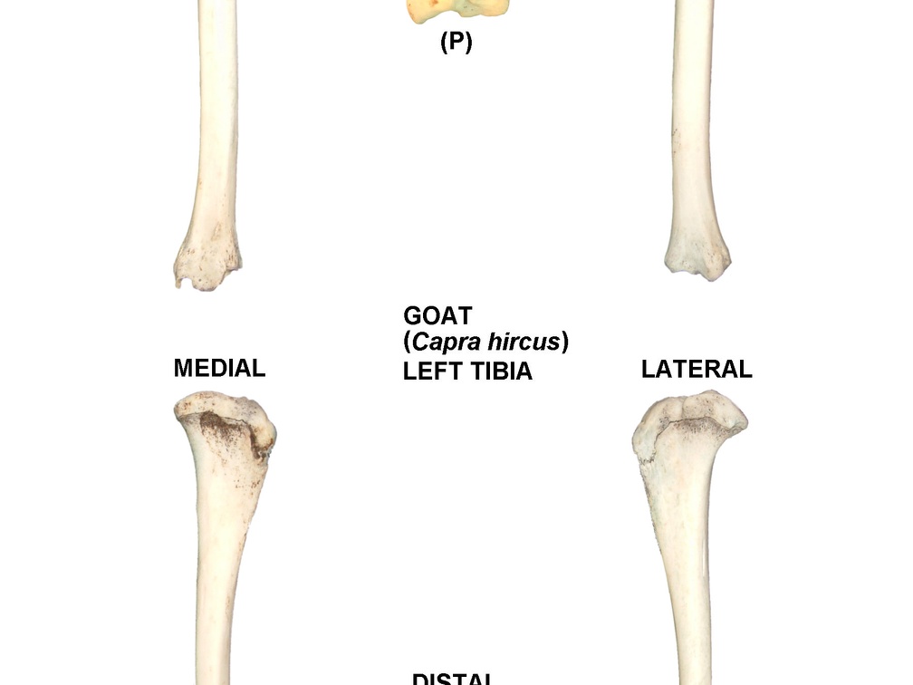 Tibia gauche