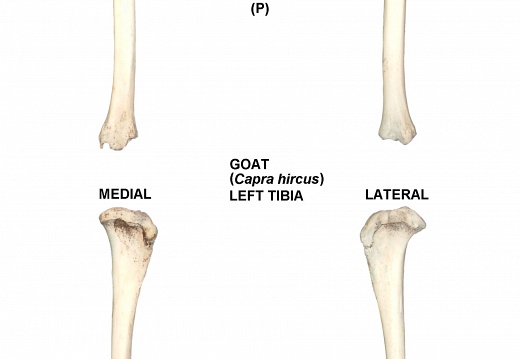 Tibia gauche