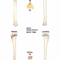 Right tibia