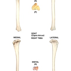 Tibia droit