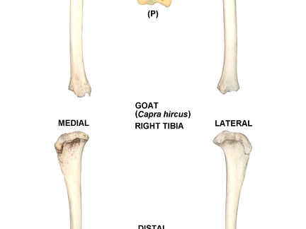 Tibia droit