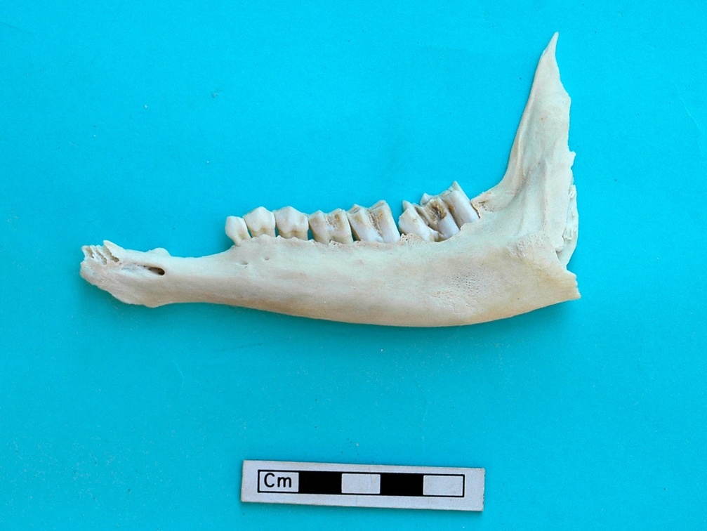 Mandibule : vue latérale