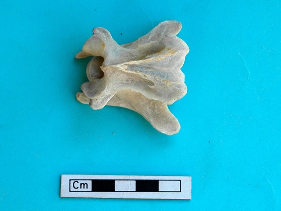 Cervical vertebra