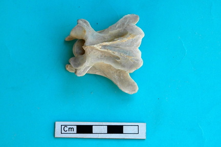 Vertèbre cervicale