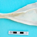 Scapula: side view