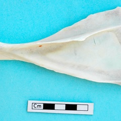 Scapula : vue latérale