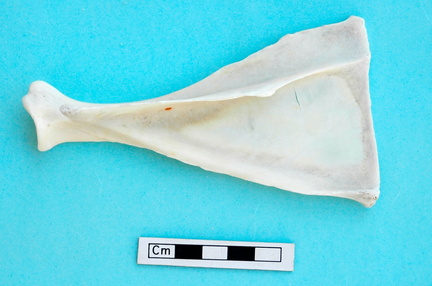 Scapula : vue latérale