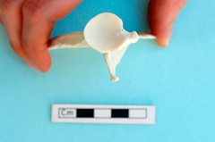 Scapula : vue ventrale