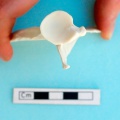 Scapula : vue ventrale