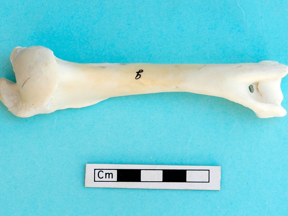 Humerus: posterior view